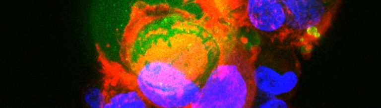 Mini-tumors from the lab simulate immune responses